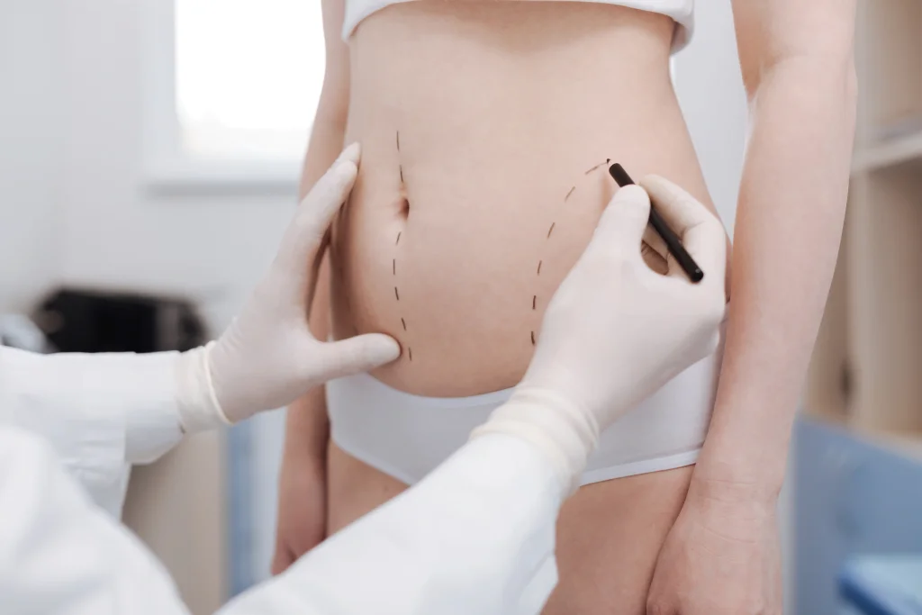 liposuction-in-istanbul-in-turkey-1024x683.png