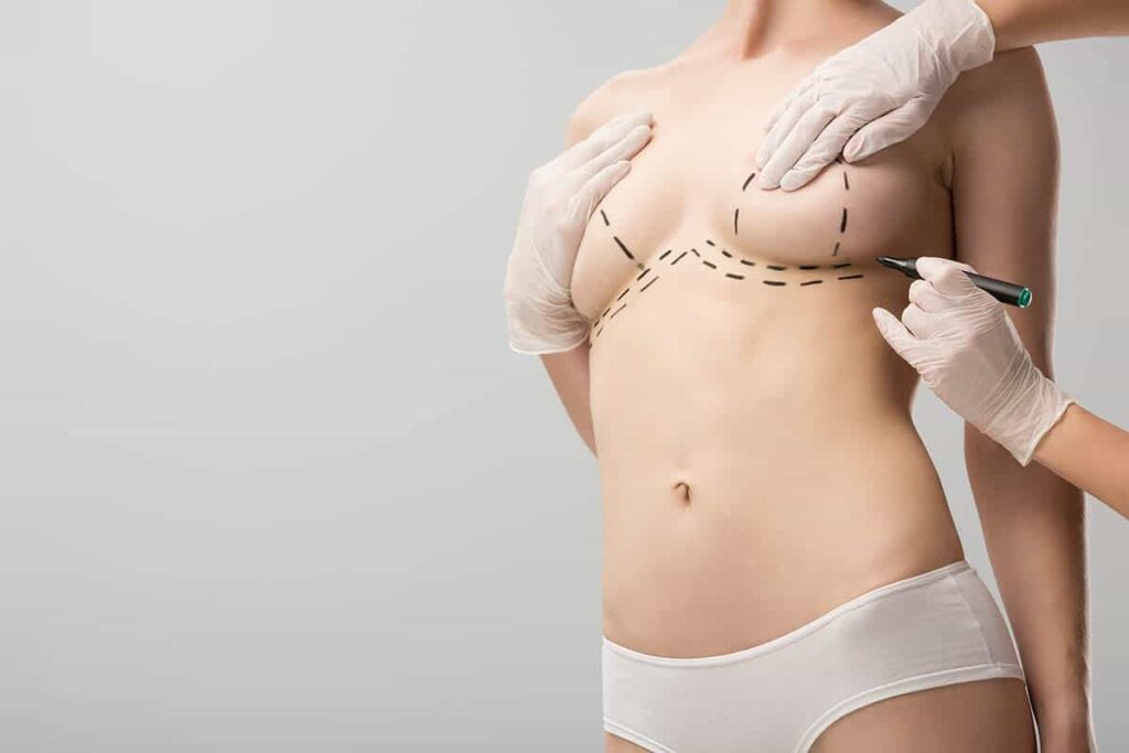 plastic-surgeon-marking-incision-sites-breast-lift-1024x683